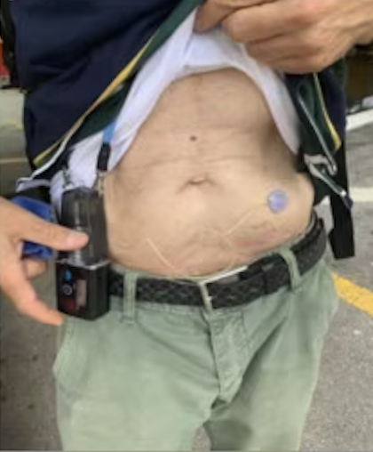 Onapgo Pump